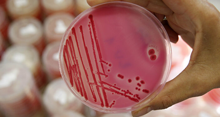 An analytical chemist shows a petri dish with salmonella in the Institute for Chemical and Veterinary Research in Stuttgart, southwestern Germany