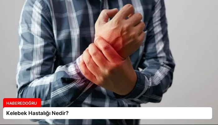 Kelebek Hastalığı Nedir?