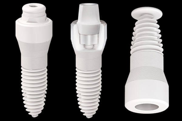  Şeffaf Plak mı Tel Tedavi mi? Yetişkinler İçin Ortodonti Rehberi